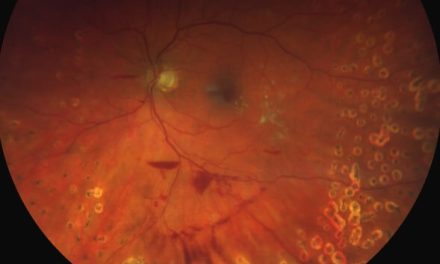 Principles of Diabetic Care