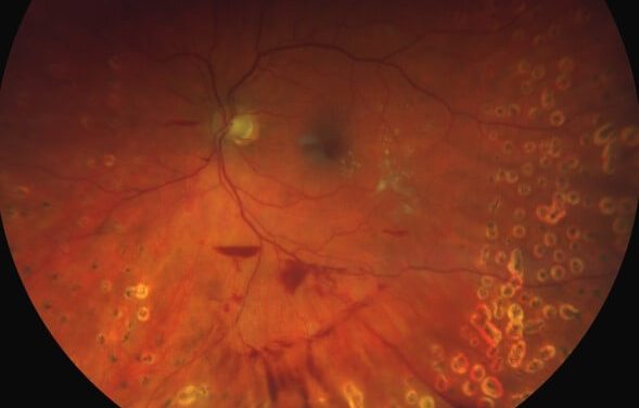 Principles of Diabetic Care