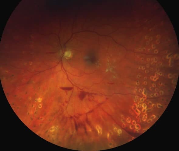 Principles of Diabetic Care