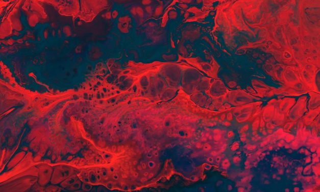 Neovascular Glaucoma: A Case Report and Literature Review