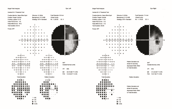 figure 1 vf lymphoma