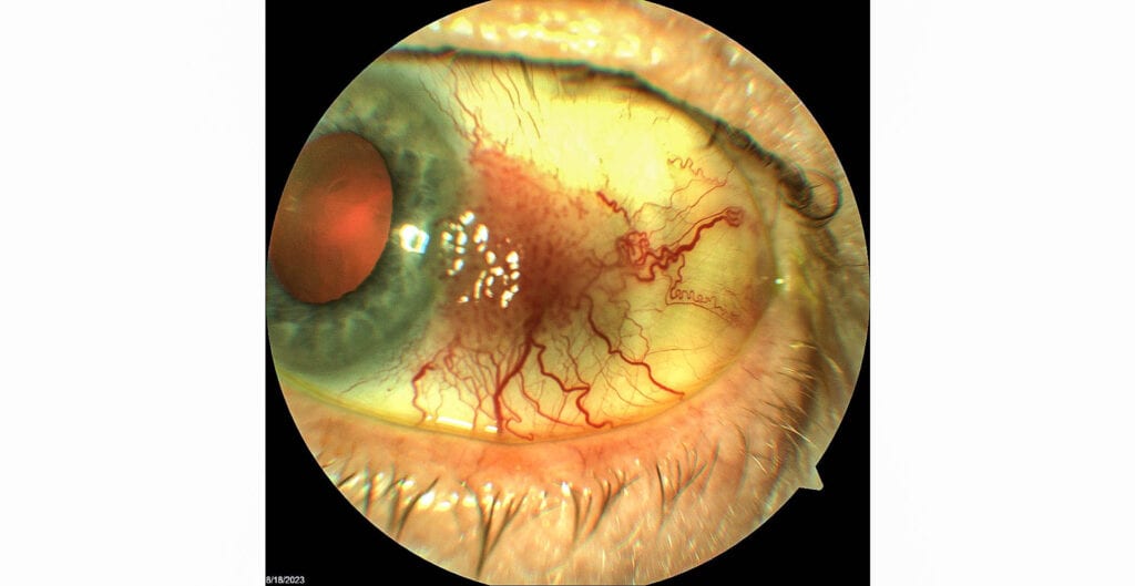 figure 1 cin and main image