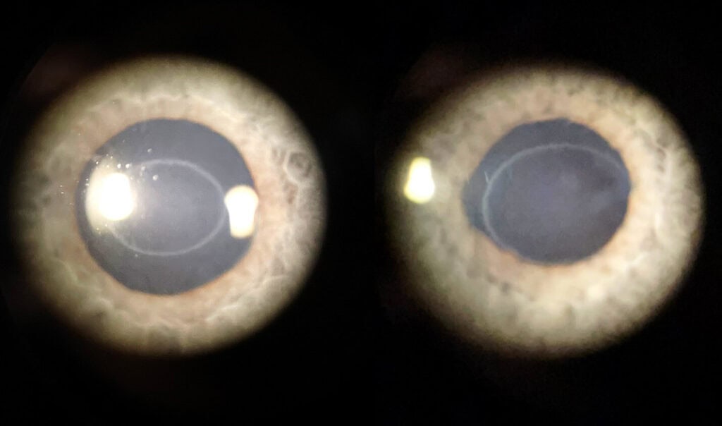 figure 1 ascher ring (1)