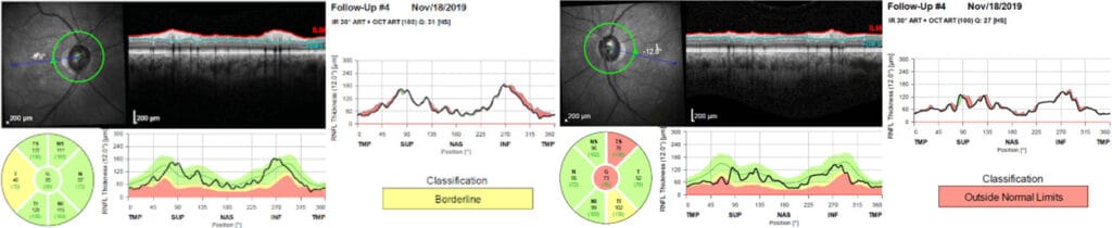 imgonline com ua twotoone 2gpri8robe0a