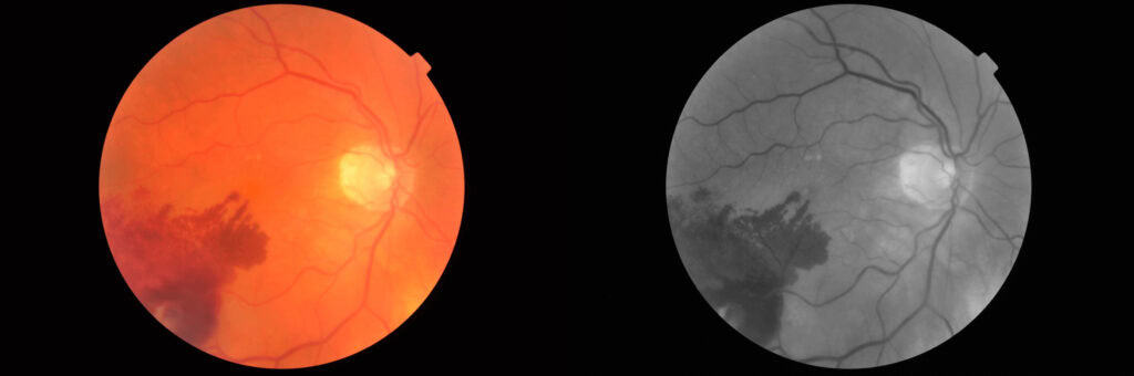 imgonline com ua twotoone 5esdhbzwaozoc