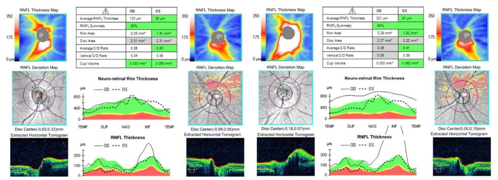 figure 2 baseline (2)