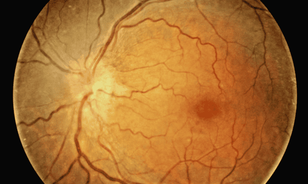 Incipient NAION vs Classic NAION with Vision Loss