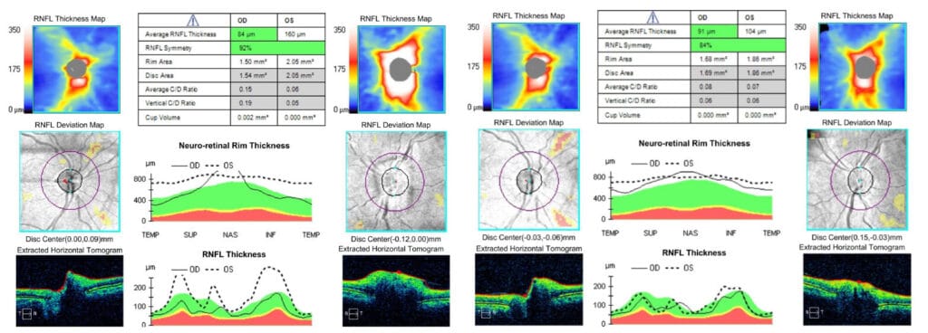 figure 5 baseline (1)