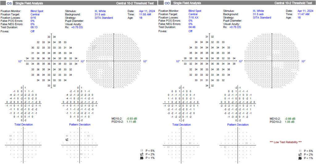 imgonline com ua twotoone 2fsp8xixes