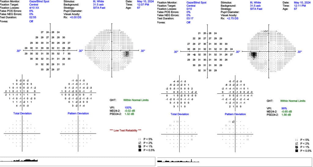 imgonline com ua twotoone pizcm1saox