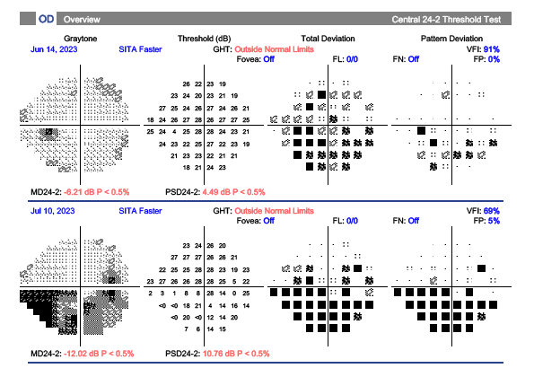 figure 3 (hvf)