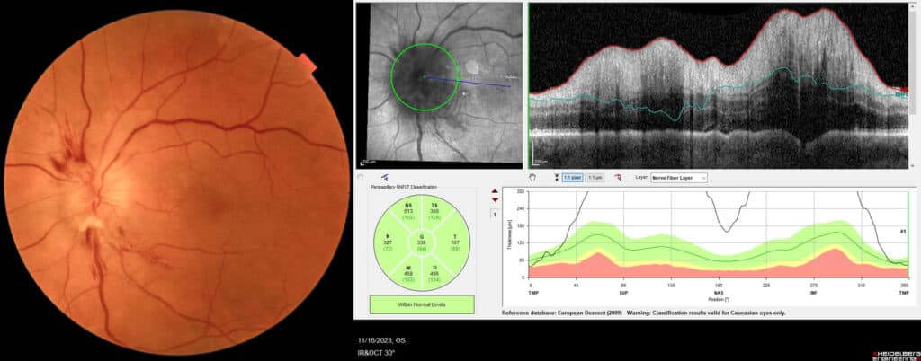 imgonline com ua twotoone niwfgiqqhba