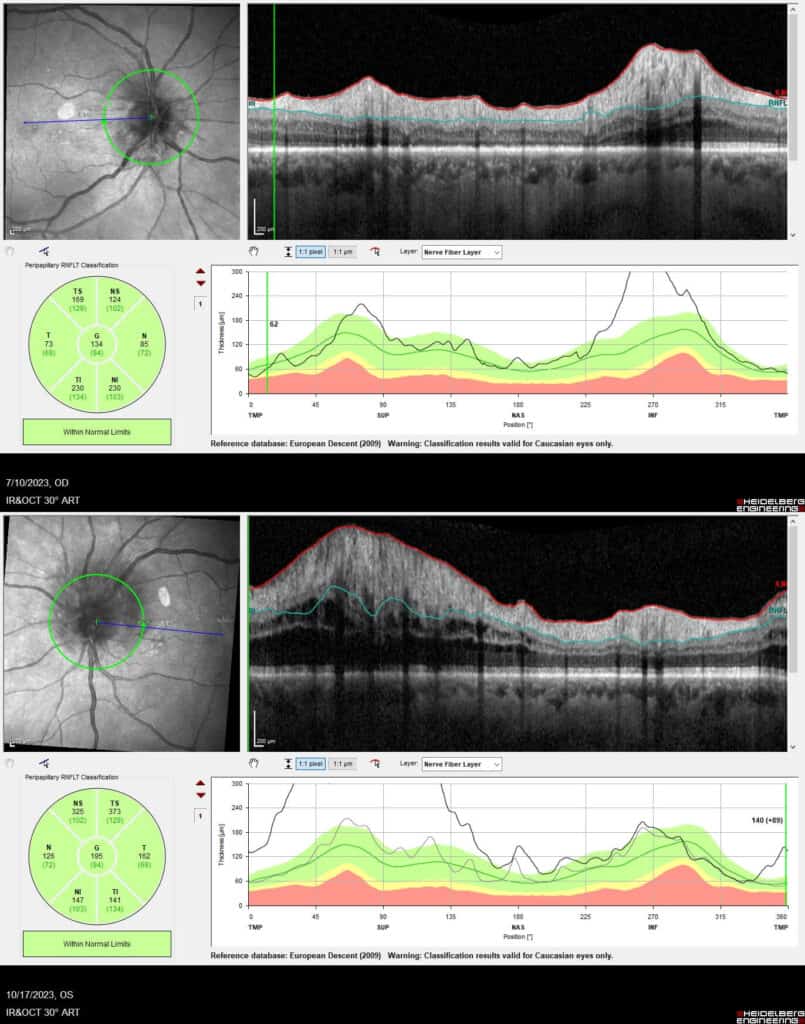 imgonline com ua twotoone yagl210utoywnw