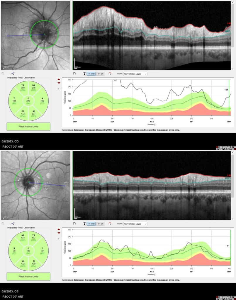 imgonline com ua twotoone jwkp8zkpgnh6xkjt