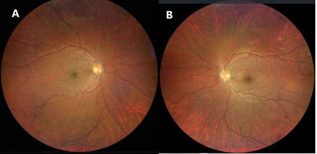 imgonline com ua twotoone pjbw9jvdxrku (1)