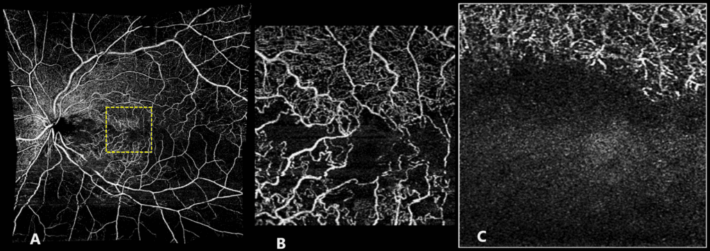 crvo figure 2 combined new (1)