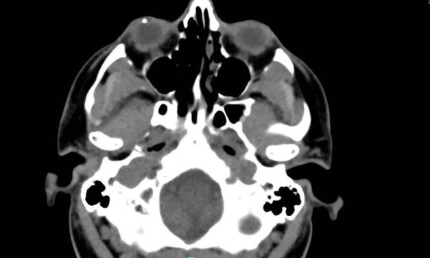 PHOTO ESSAY: Management of Penetrating Injuries and Intraocular Foreign Bodies