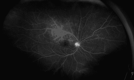Guess the Disease: When the Great Masquerader Unveils Its Disguise