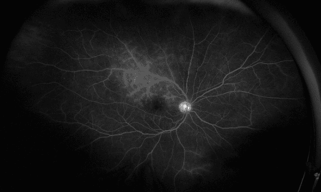 Guess the Disease: When the Great Masquerader Unveils Its Disguise