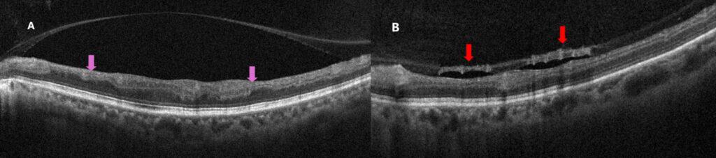 imgonline com ua twotoone leim6pbfnyjz3 (1)
