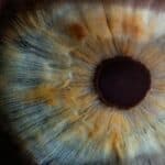 A Rare Case of Recurrence of Bilateral Corneal Edema Secondary to Amantadine