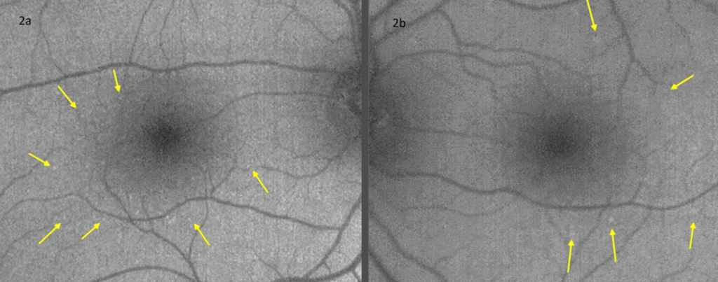bydm figure 2b labeled (medium)(1) imageonline.co merged