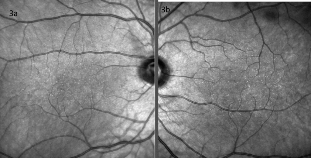 bydm figure 3b labeled (medium)(1) imageonline.co merged