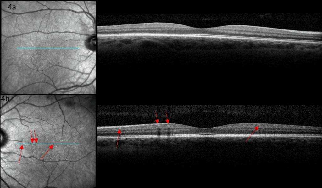 bydm figure 4b labeled (medium)(1) imageonline.co merged