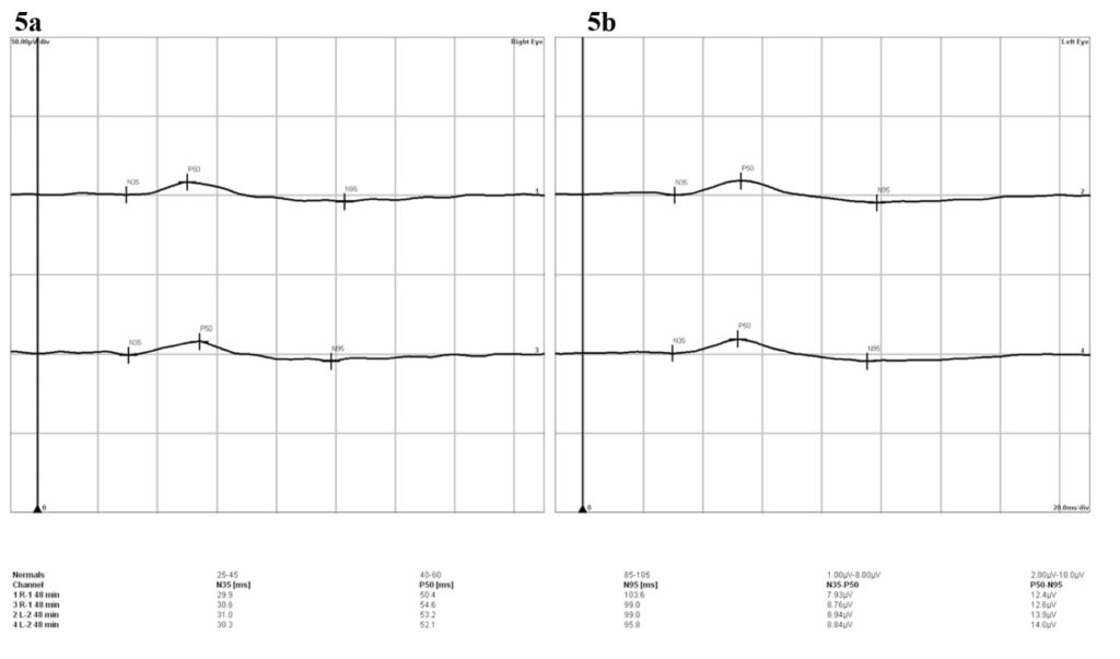 bydm figure 5 (medium)(1)