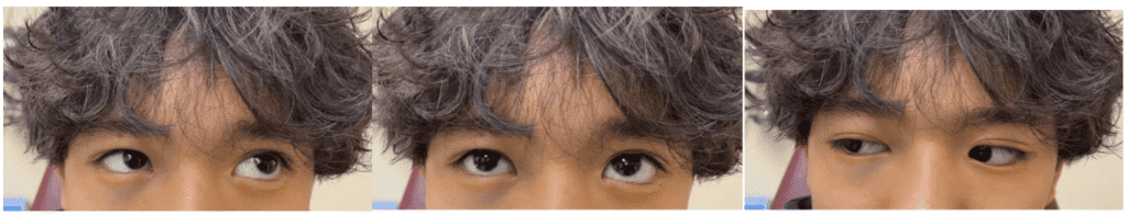 orbital fx figure 1 (medium)(1)