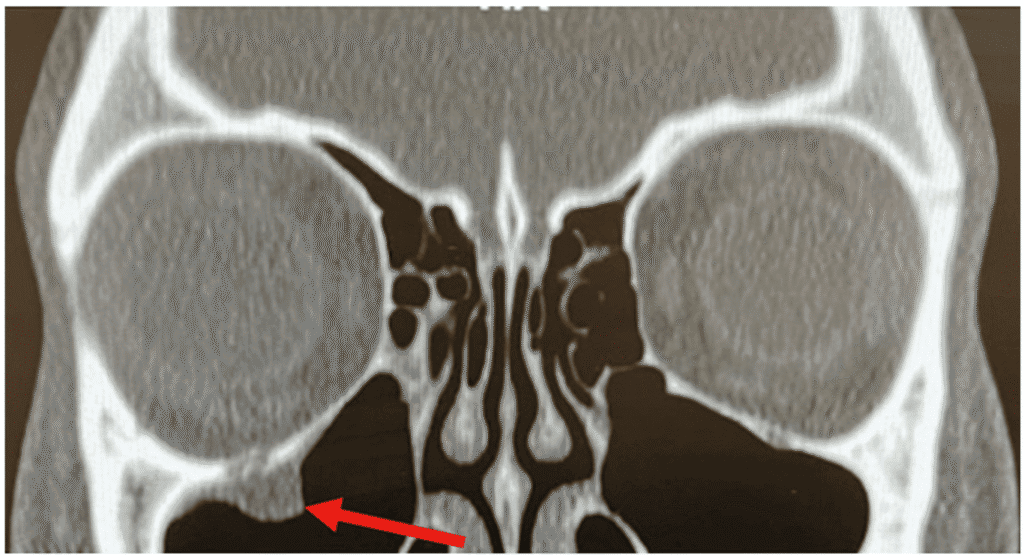 orbital fx figure 2 (medium)(1)