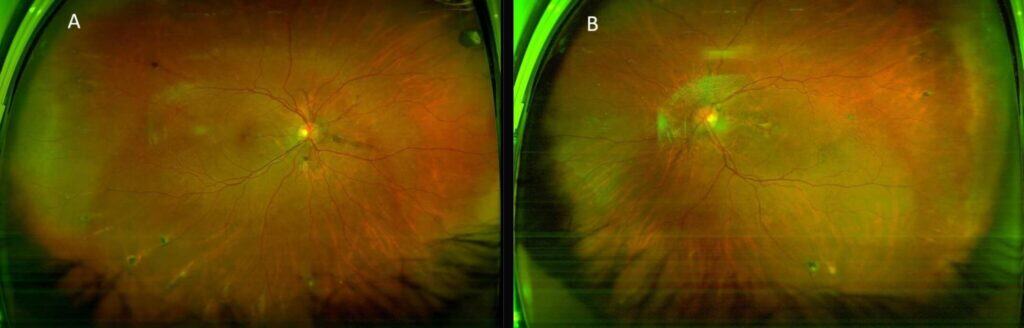 pxe fig 1b (medium) imageonline.co merged