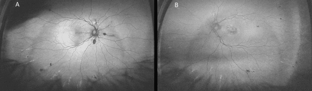 pxe fig 2b(1) (medium) imageonline.co merged