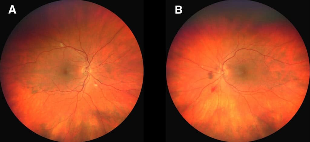 figure 2b(1) imageonline.co merged(1)