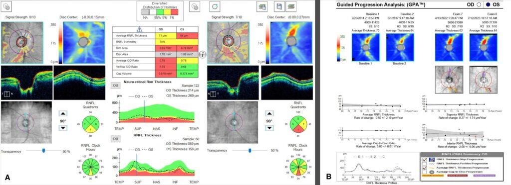 pprs figure 1b(1) imageonline.co merged