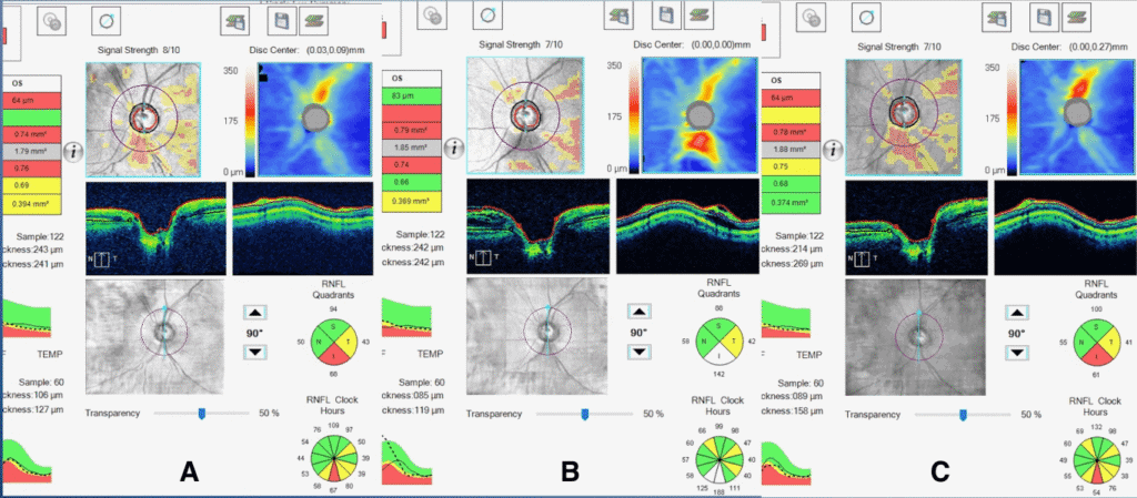 pprs figure 2(1) (medium)