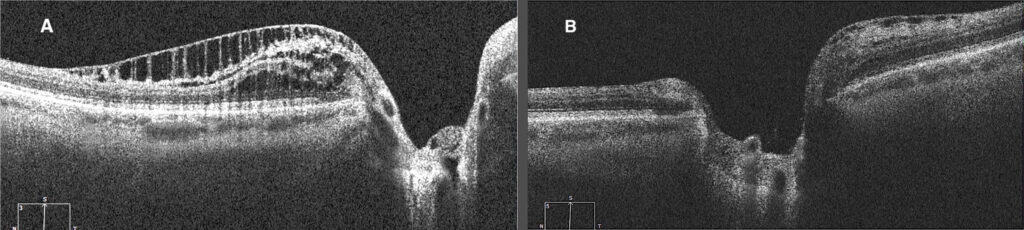 pprs figure 3b(1) (medium) imageonline.co merged