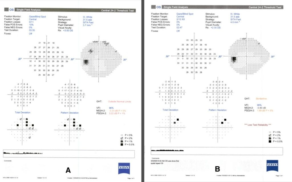 pprs figure 4b(1) (medium) imageonline.co merged(1)