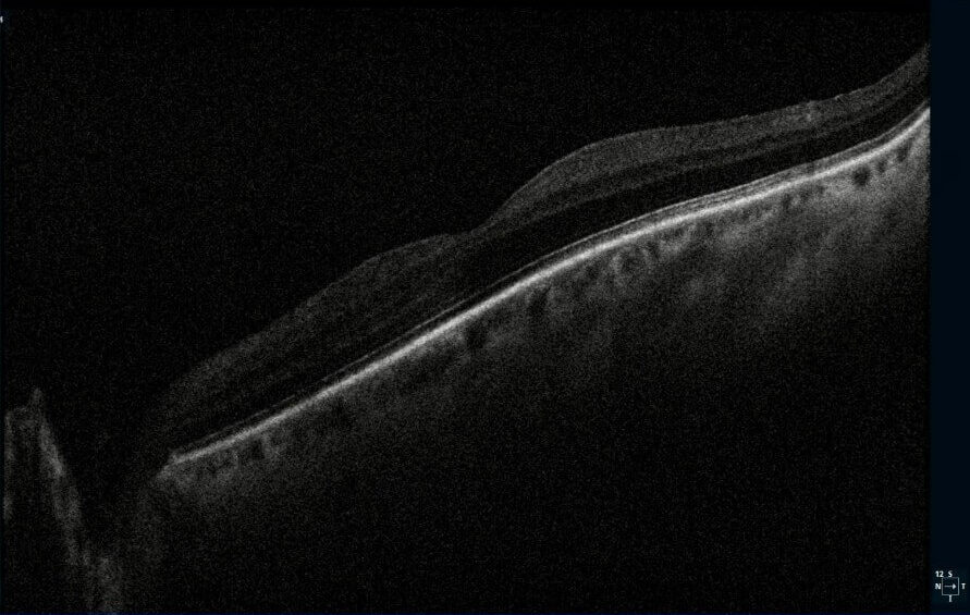 photo essay figure 2 (medium)