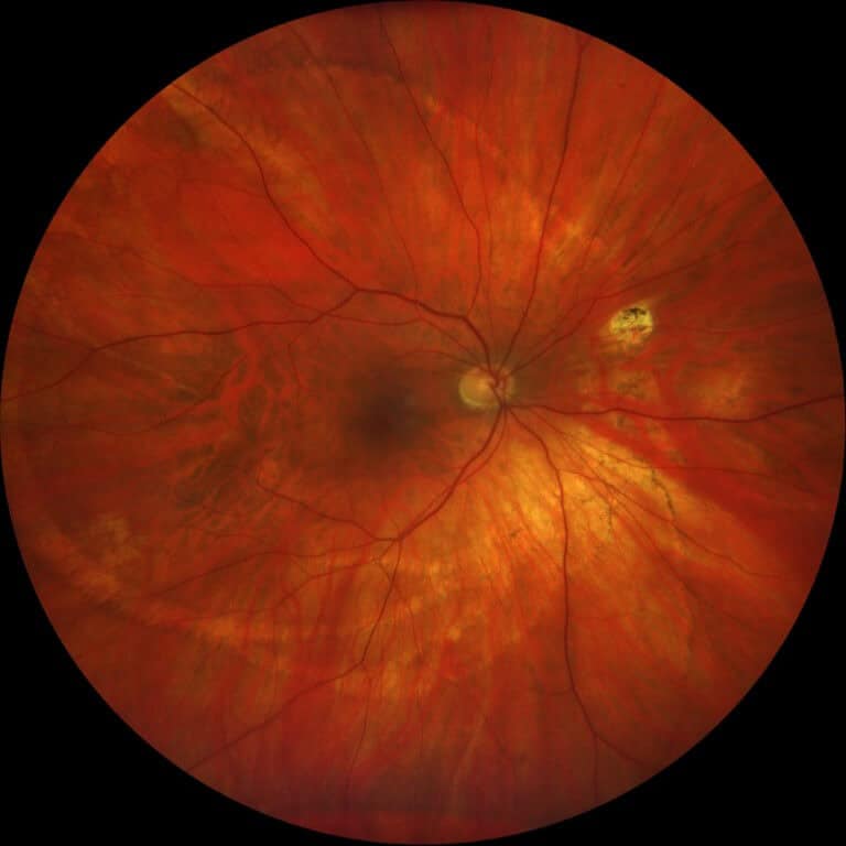 photo essay figure 3 (medium)