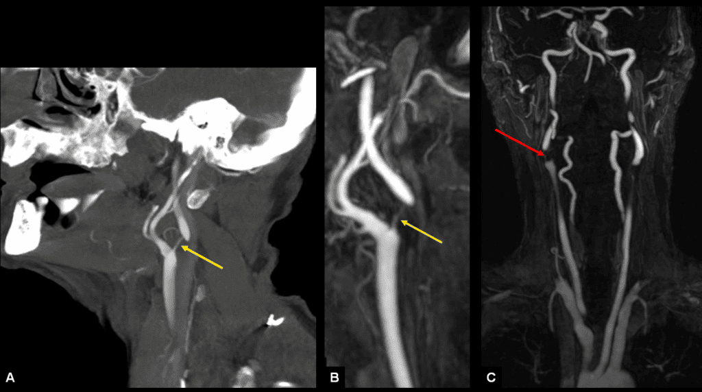 nn figure 3 (1)
