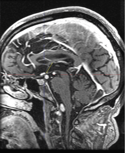 figure 4 doli (1)