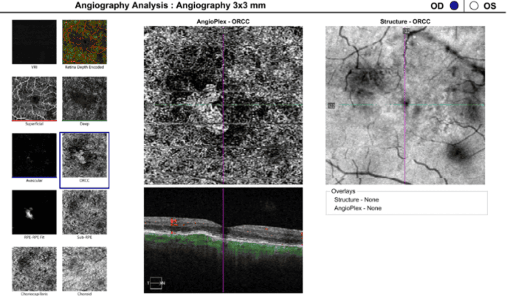 figure 5 mnv (1)