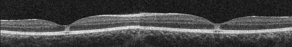 solar ret fig 5