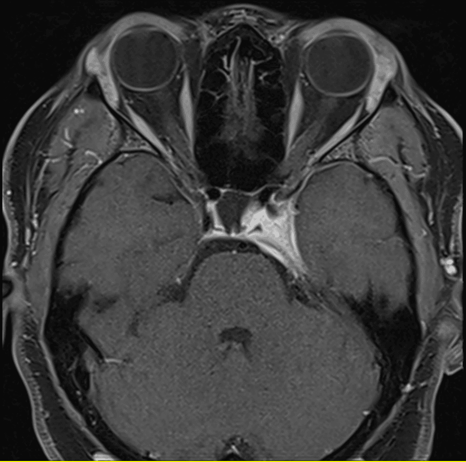figure 4 mri (1)