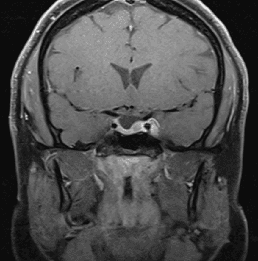 figure 5 mri (1)