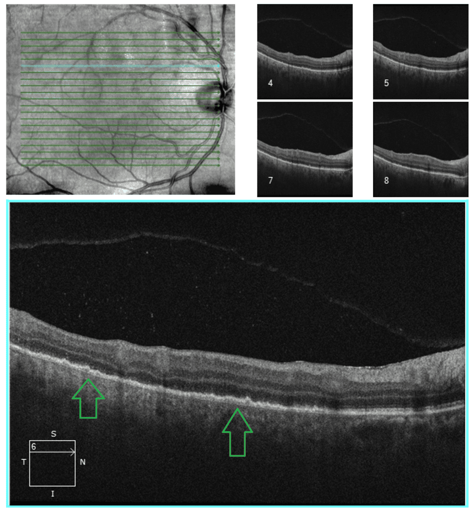 figure 5 (1)