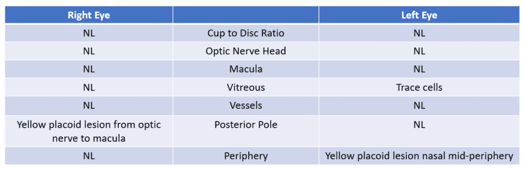 findings post seg