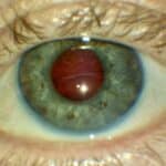 Diplopia Detective – Case 2