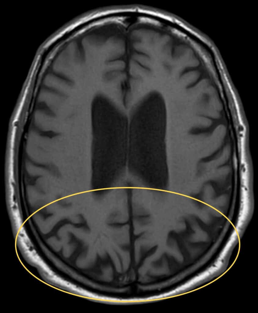 pca fig 2(1)